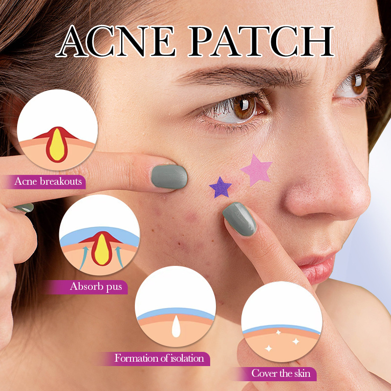 7/10/14Pcs Colorful Star Acne  - مراجعة Skincare Qv وسعره