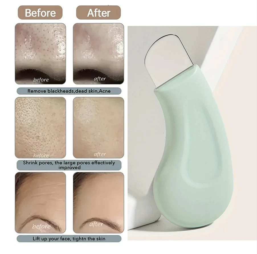 Professional Blackhead and Whi - مراجعة Skincare Qv وسعره