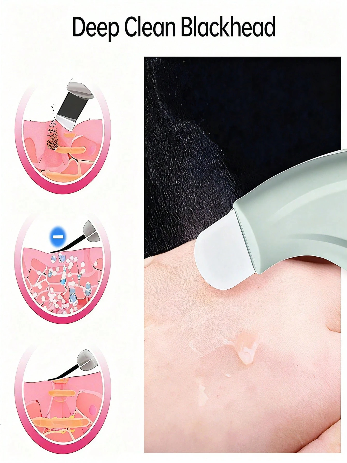 Professional Blackhead and Whi - مراجعة Skincare Qv وسعره