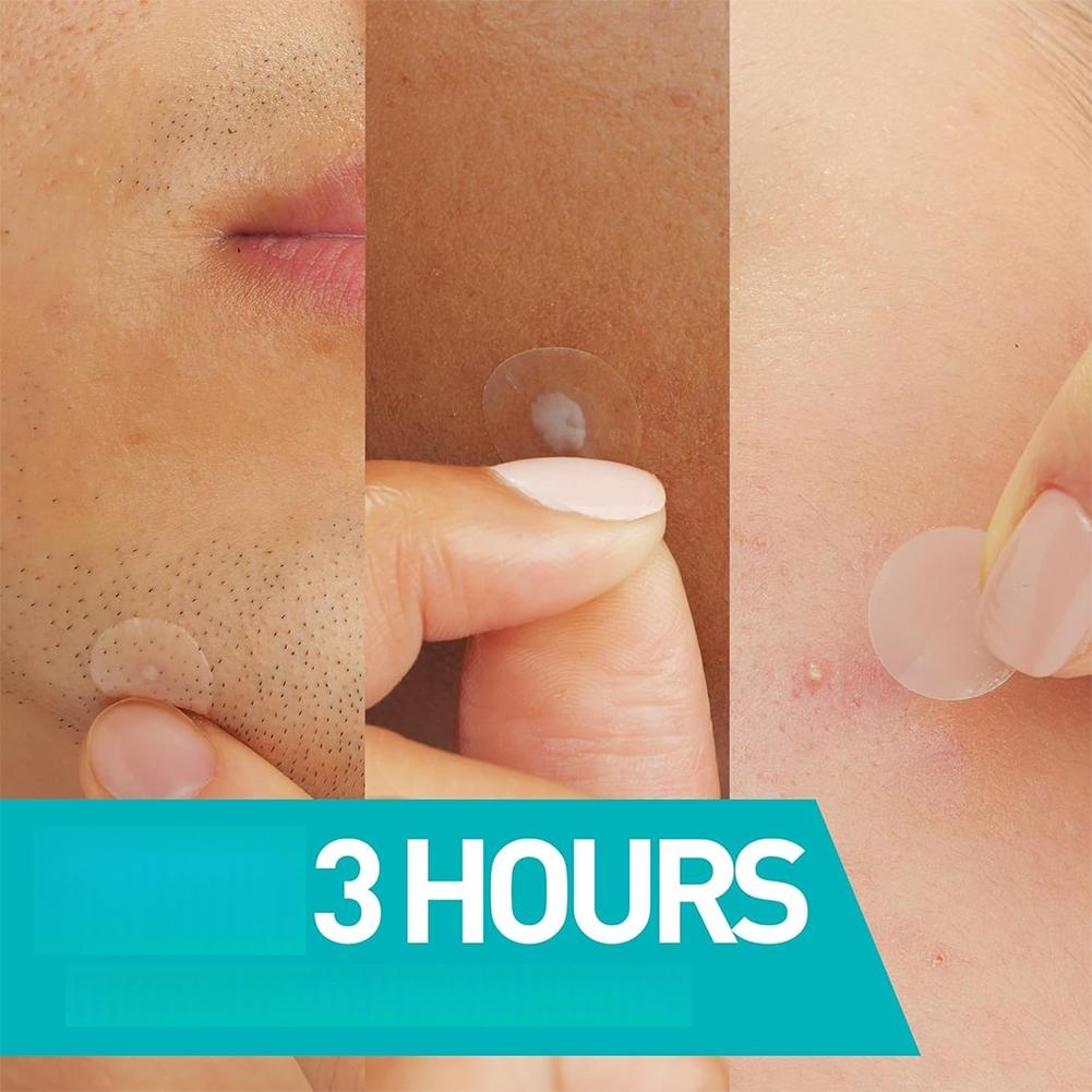 Invisible Pimple Patch 24/200/ - مراجعة Skincare Qv وسعره