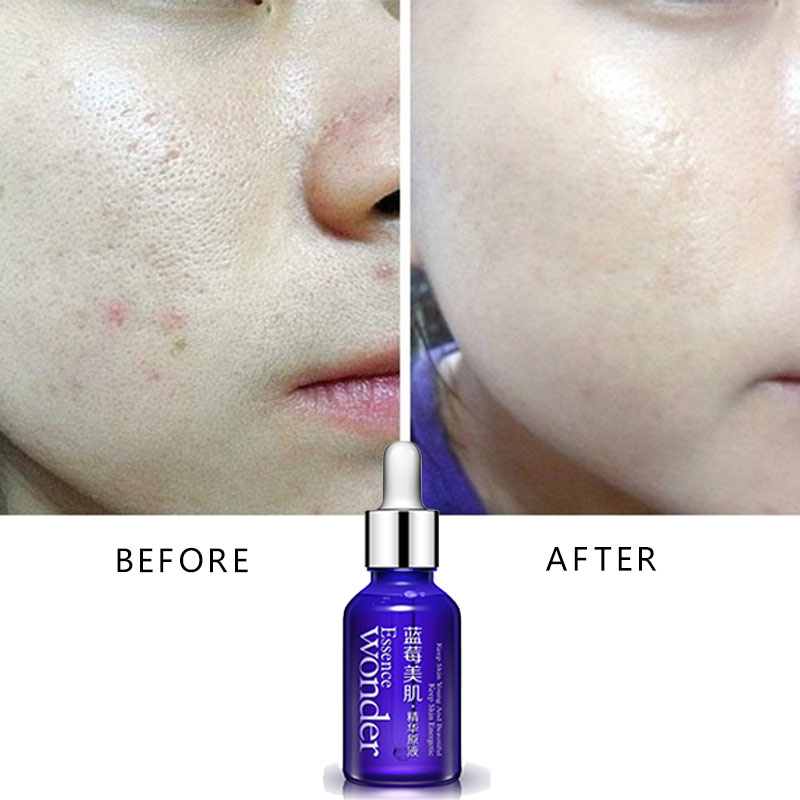 BIOAQUA Blueberry Face Lifting - مراجعة Skincare Bioaqua وسعره