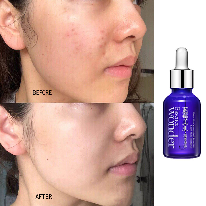 BIOAQUA Blueberry Face Lifting - مراجعة Skincare Bioaqua وسعره