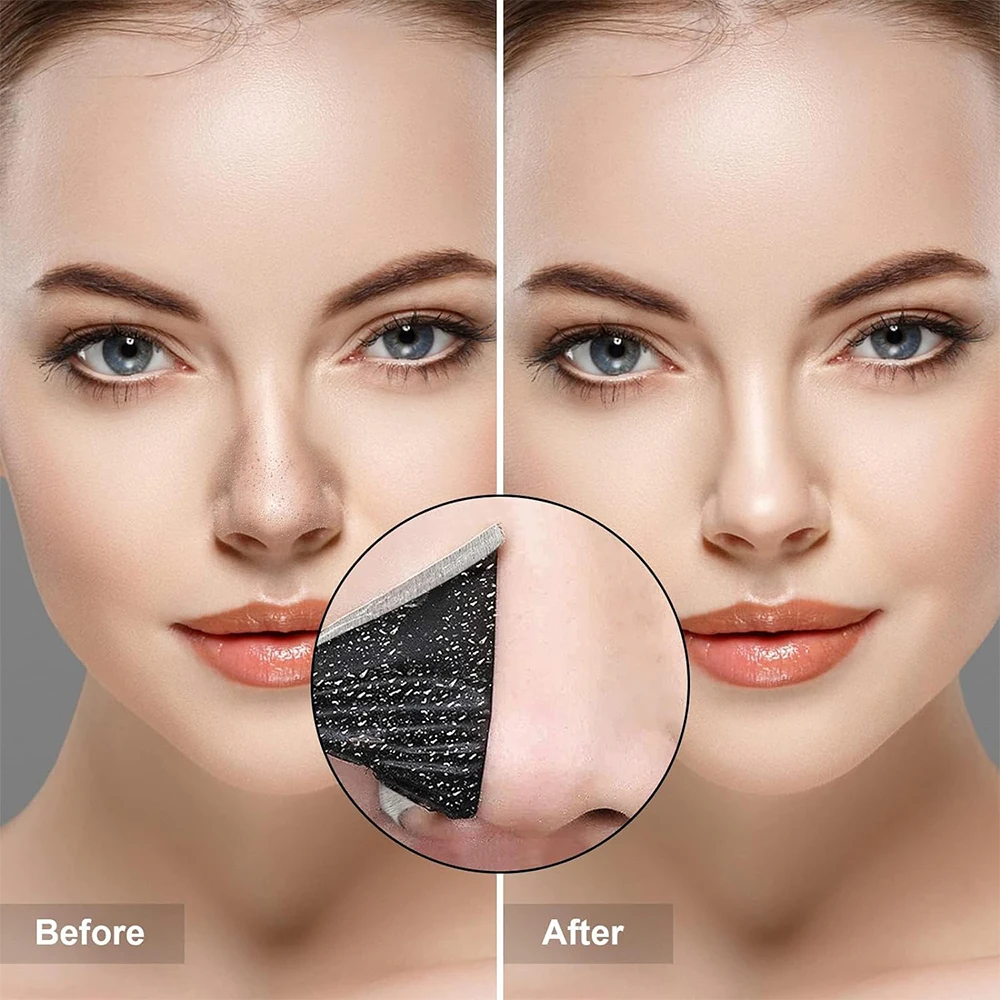 10PCS Unisex Blackhead Remove  - مراجعة Skincare Qv وسعره