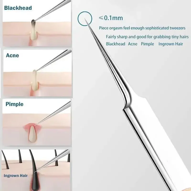 11Pcs/Set Acne Needle Blackhea - مراجعة Skincare Qv وسعره