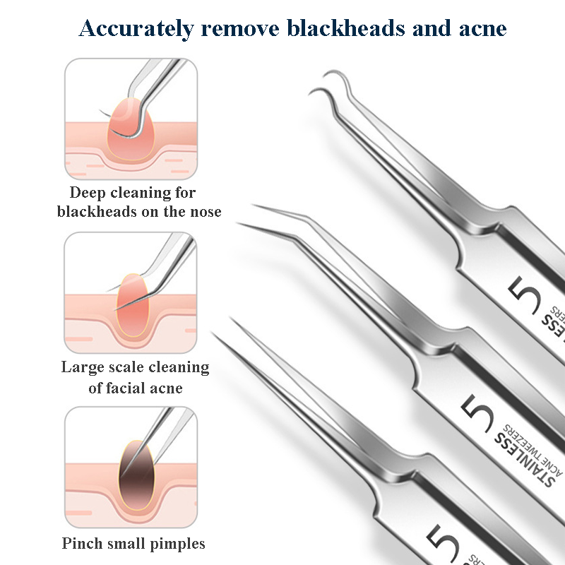 4-11Pcs Ingrown Hair Tweezers  - مراجعة Skincare Qv وسعره