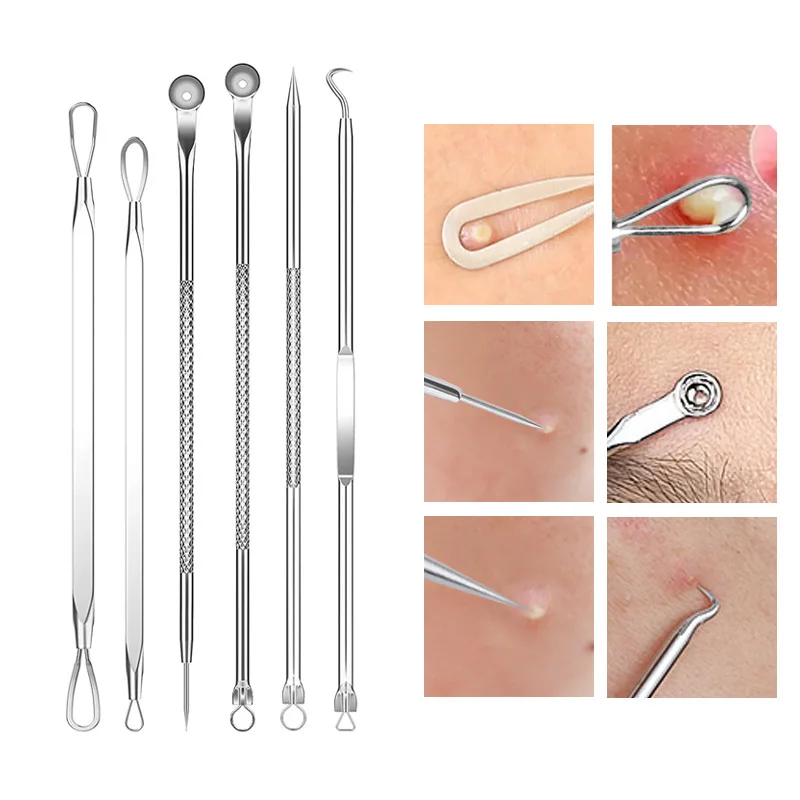 4-11Pcs Ingrown Hair Tweezers  - مراجعة Skincare Qv وسعره